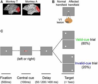 Informative Cues Facilitate Saccadic Localization in Blindsight Monkeys